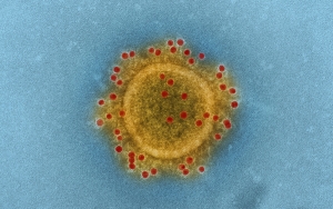 Virus, demagogia y boomerang